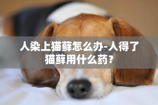 人染上猫藓怎么办-人得了猫藓用什么药？